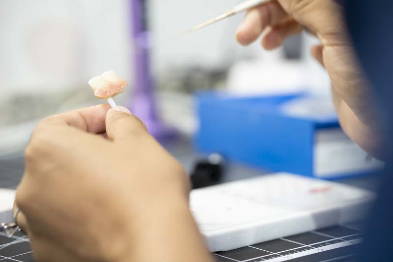 Na'at Laboratorio Dental