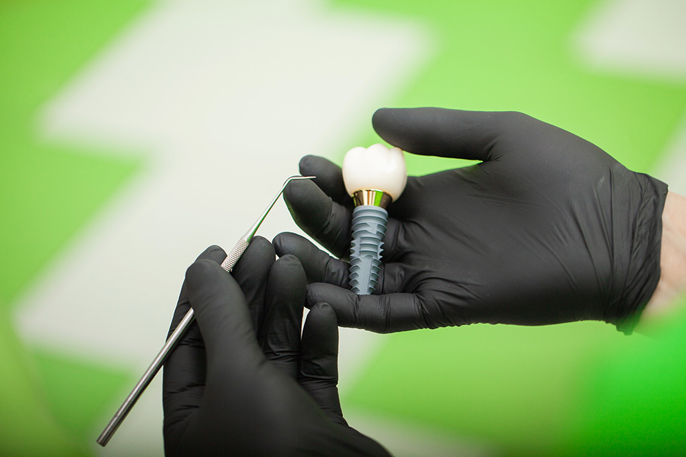 Injerto óseo dental: el paso previo y fundamental para el éxito de tus implantes a largo plazo