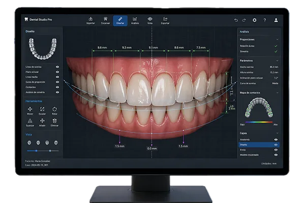 Diseño de Sonrisa Digital y Odontología Cosmética